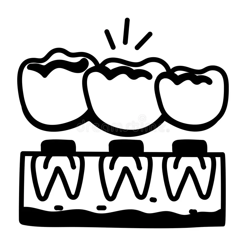 Best Metal Dental Bridge in Indirapuram Best Metal Dental Bridge in Indirapuram